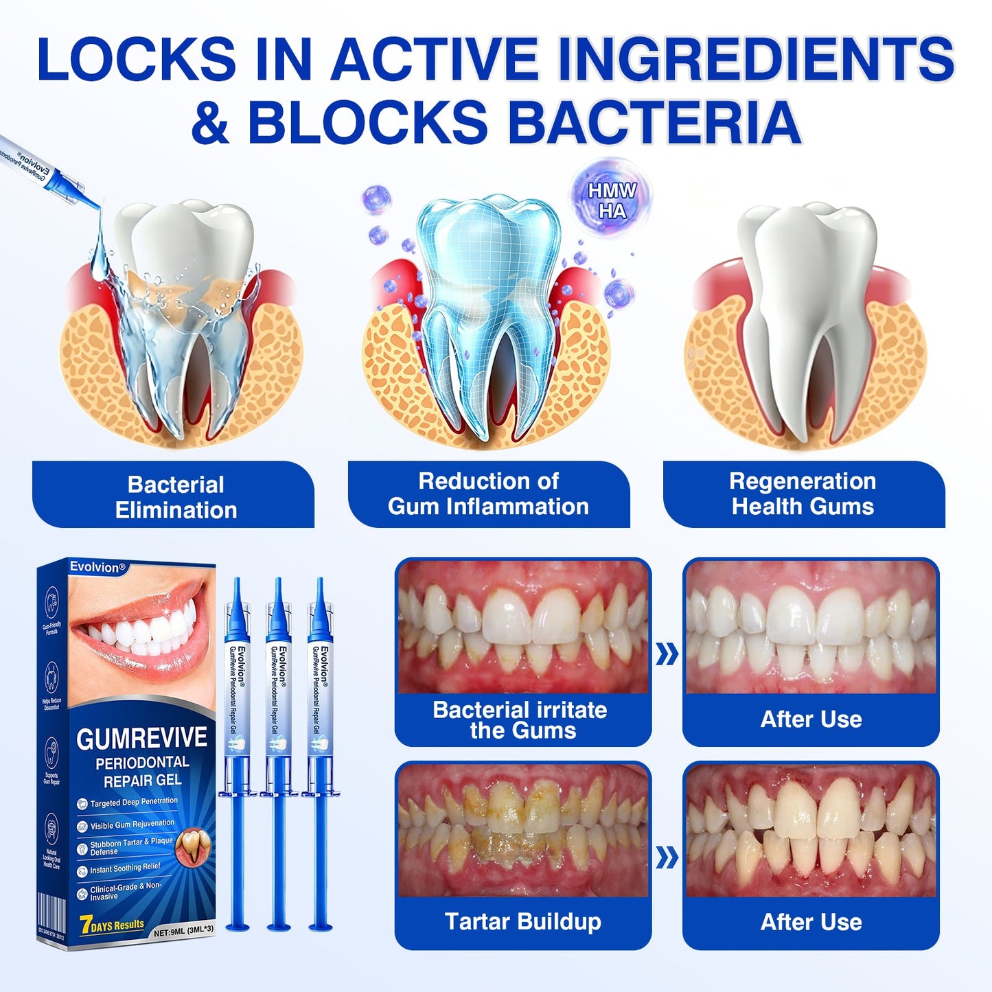 Gum Revive Periodontal Repair Gel