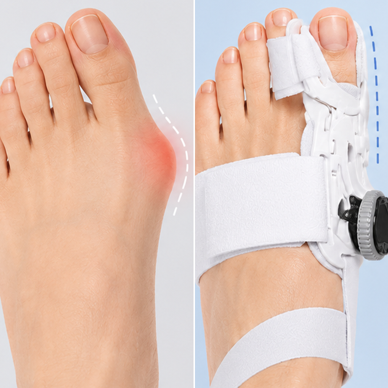 Bunion Corrector - Adjustable Bunion Splint