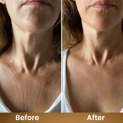 LIMETOW® Botanical Body Oil
