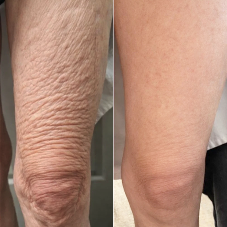 LIMETOW® Collagen Firming Cream💖LAST DAY SALE - 80% OFF