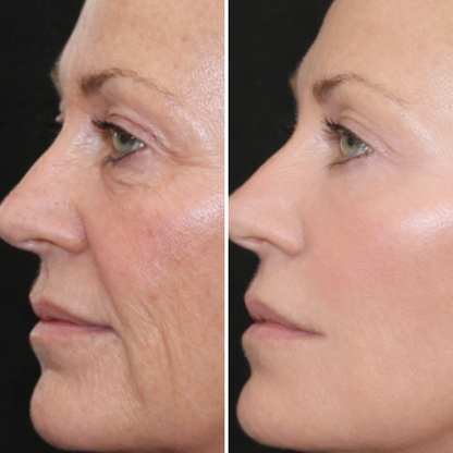 LIMETOW® Peptide 10 Lifting Filler Serum