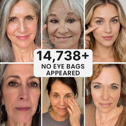 LIMETOW® Ultimate Depuff Eye Serum⚡Limited-Time Offer