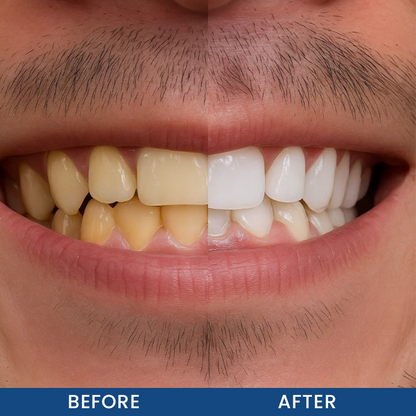 LIMETOW® Teeth Whitening Essence