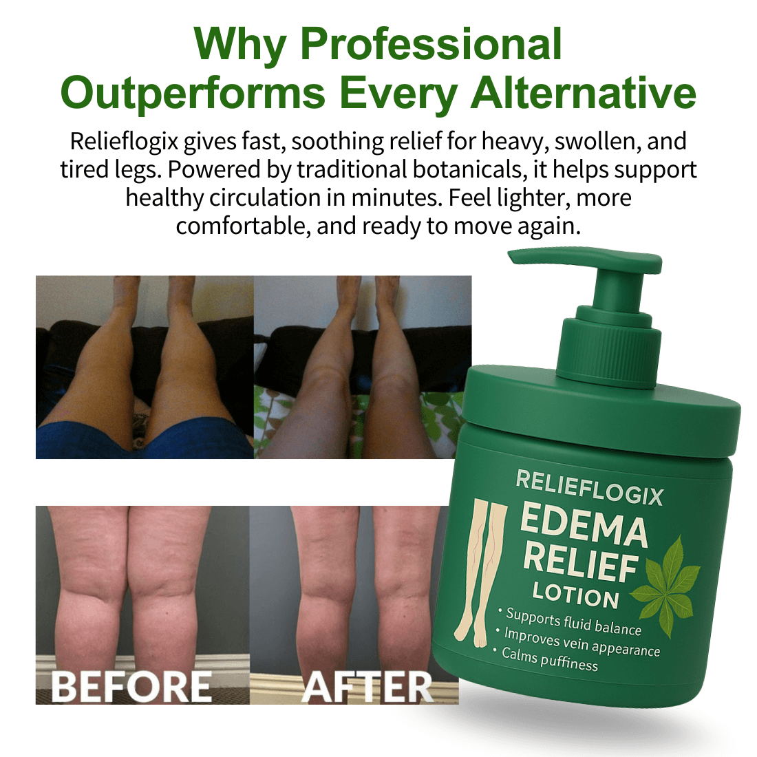 #1 Best Seller- 💥EDEMA RELIEF LOTION