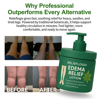 #1 Best Seller- 💥EDEMA RELIEF LOTION