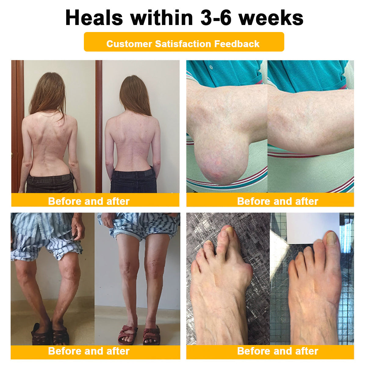 🎁Flash Sale - Botulinum Toxin & Bee Venom Pain-Relief Bone Healing Cream🐝💎