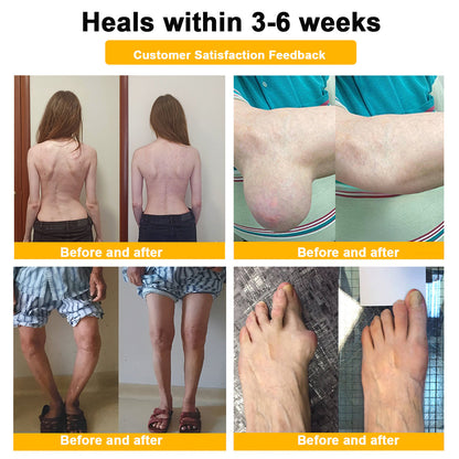 🎁Flash Sale - Botulinum Toxin & Bee Venom Pain-Relief Bone Healing Cream🐝💎