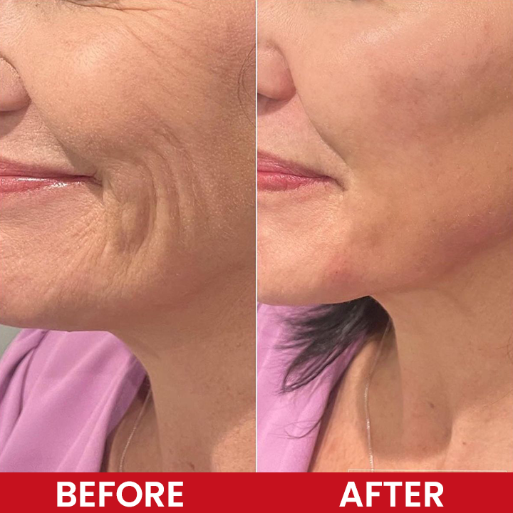 LIMETOW® EGF+NAD Firming Serum