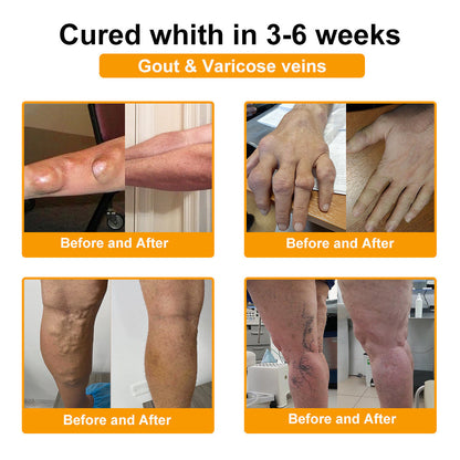 🎁Flash Sale - Botulinum Toxin & Bee Venom Pain-Relief Bone Healing Cream🐝💎