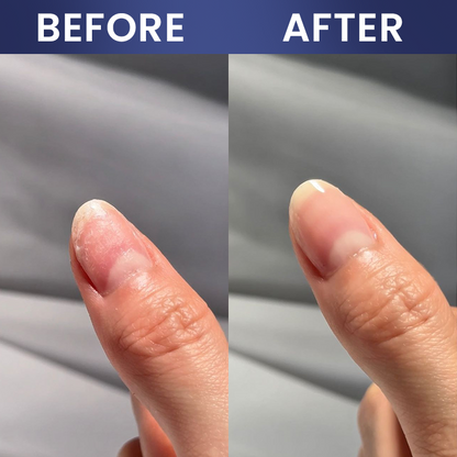 LIMETOW® Nail Repair Solution