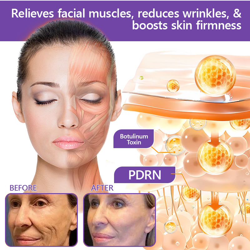 Limited-Time Offer⚡LIMETOW® PDRN Multi-Peptide Massaging Body Roller Cream- ✨𝐀𝐧𝐭𝐢-𝐚𝐠𝐢𝐧𝐠, Hydrating, Skin Firming & Lifting, Skin Repair, Even Tone, Acne and Dark Spot Treatment, Wart and Mole Removal, and Psoriasis Relief