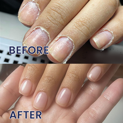 LIMETOW® Nail Repair Solution