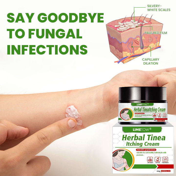 LIMETOW® Herbal Tinea Itching Cream image LIMETOW® Herbal Tinea Itching Cream
