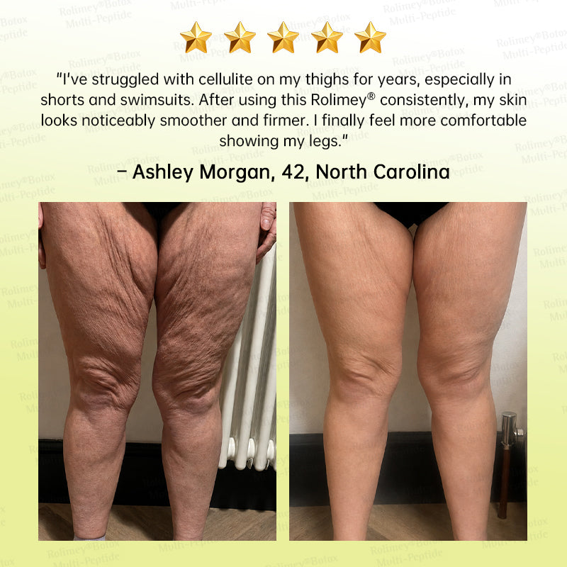 🏅💧💐Rolimey® Multi-Peptide Retinol Shot Wrinkle-Lift Cream