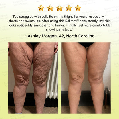 🏅💧💐Rolimey® Multi-Peptide Retinol Shot Wrinkle-Lift Cream