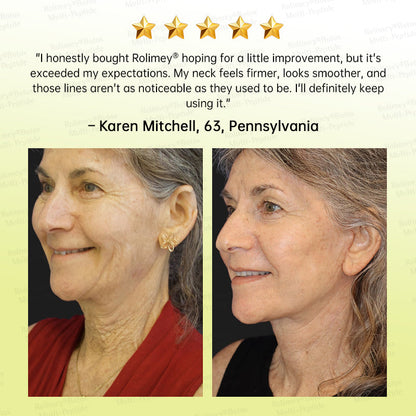 🏅💧💐Rolimey® Multi-Peptide Retinol Shot Wrinkle-Lift Cream