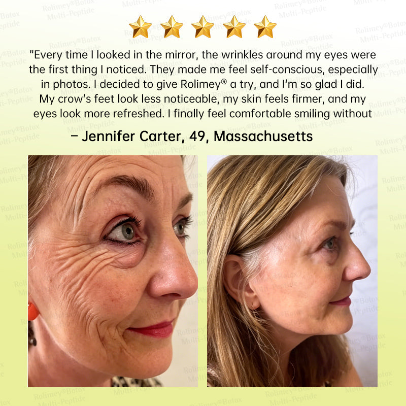 🏅💧💐Rolimey® Multi-Peptide Retinol Shot Wrinkle-Lift Cream