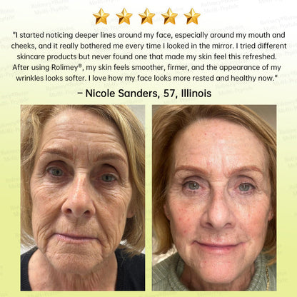 🏅💧💐Rolimey® Multi-Peptide Retinol Shot Wrinkle-Lift Cream