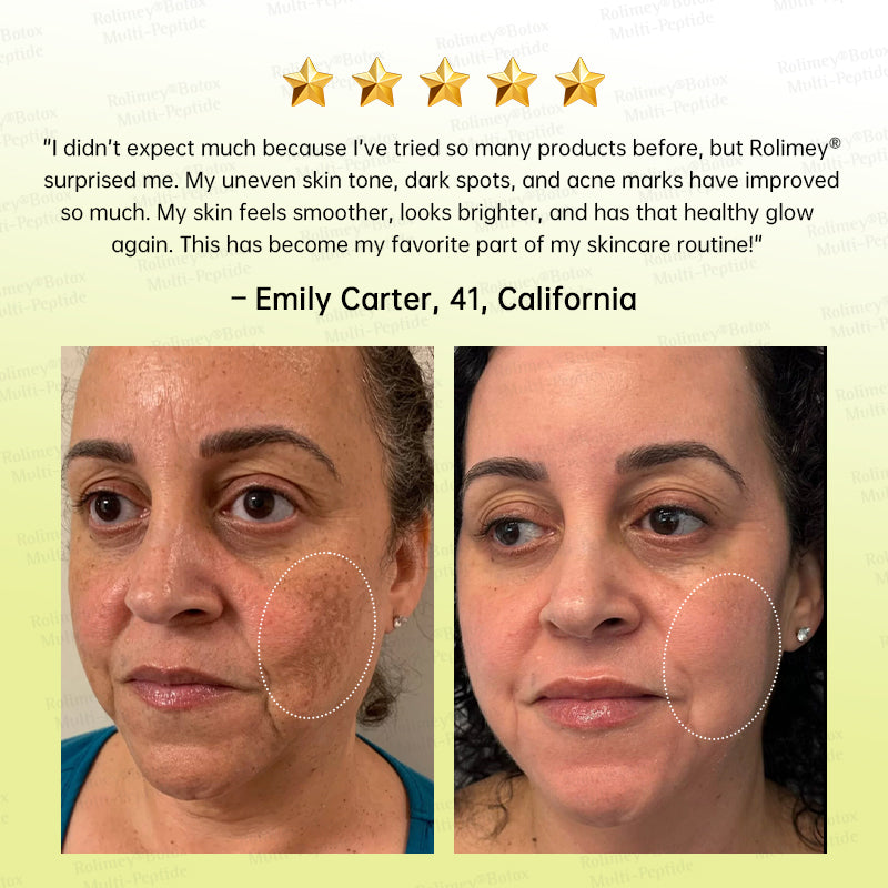 🏅💧💐Rolimey® Multi-Peptide Retinol Shot Wrinkle-Lift Cream