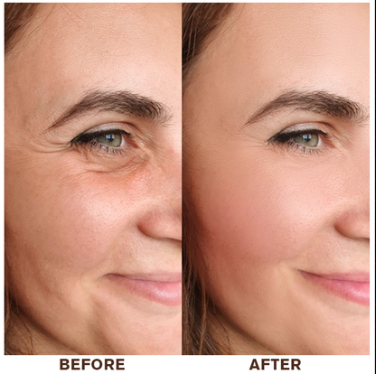 LIMETOW®Instant Eye Cream Tightener