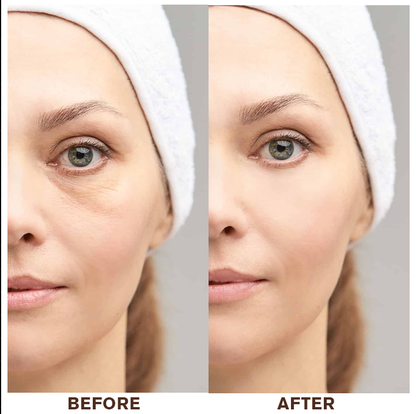 LIMETOW®Instant Eye Cream Tightener
