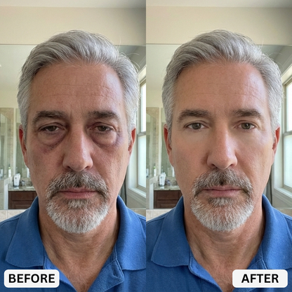 Eye Repair Stick