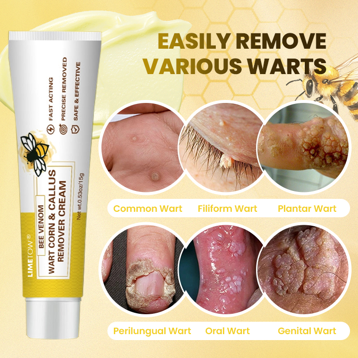 LIMETOW® Bee Venom Corn & Callus Remover Cream
