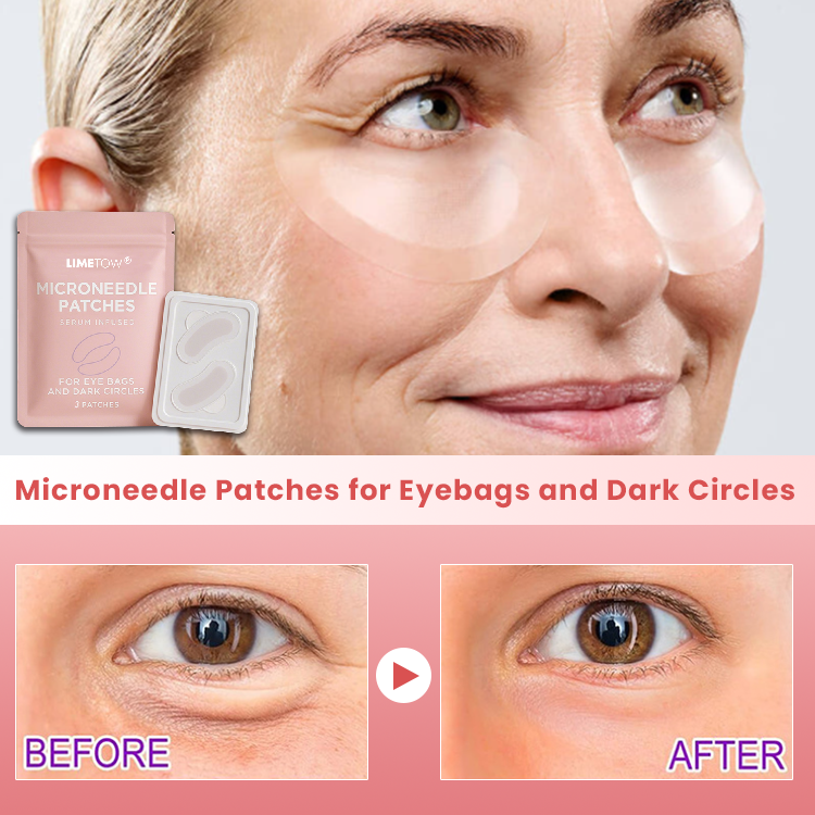 LIMETOW® Microneedle Patches for Eyebags and Dark Circles