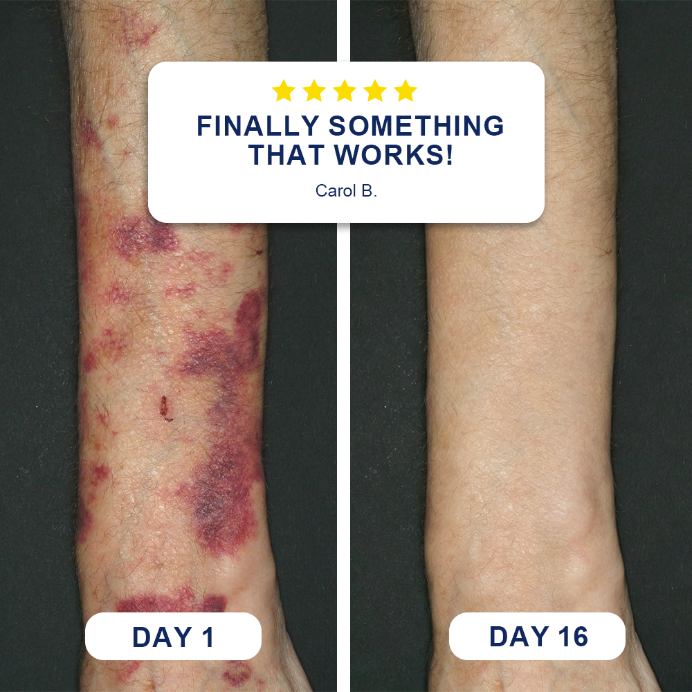 Bruise Repair & Skin-Strengthening Cream