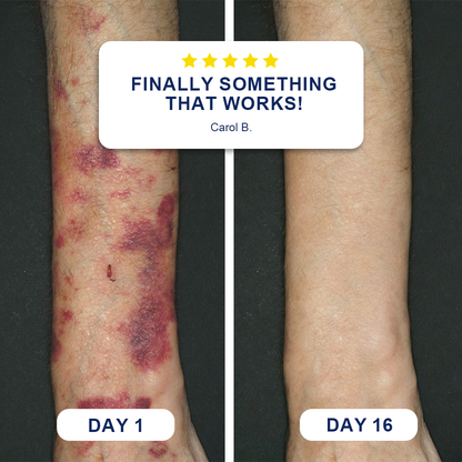 Bruise Repair & Skin-Strengthening Cream