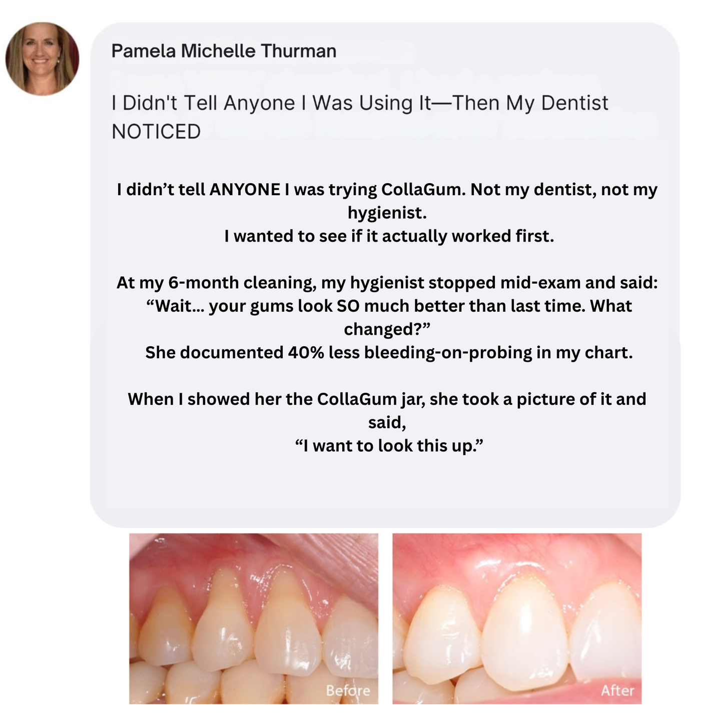 Collagum Smile Strengthening Collagen Powder
