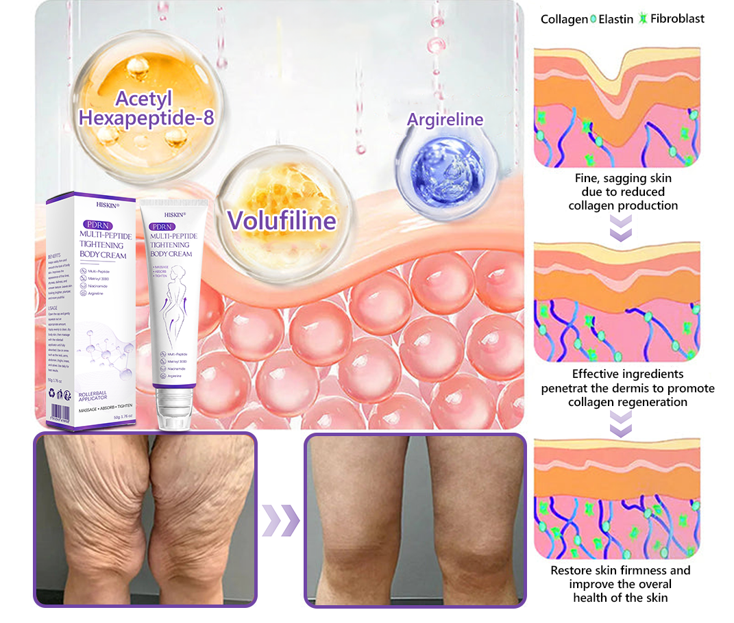 Limited-Time Offer⚡LIMETOW® PDRN Multi-Peptide Massaging Body Roller Cream- ✨𝐀𝐧𝐭𝐢-𝐚𝐠𝐢𝐧𝐠, Hydrating, Skin Firming & Lifting, Skin Repair, Even Tone, Acne and Dark Spot Treatment, Wart and Mole Removal, and Psoriasis Relief