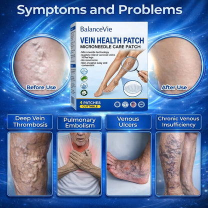 Stop Wasting Money on Useless Varicose Vein Creams That Can't Penetrate Where It Matters
