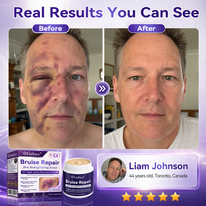 LIMETOW® Bruise Repair & Skin-Strengthening Cream