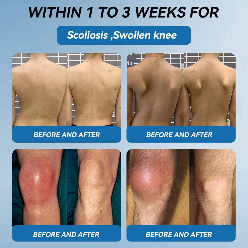 | 𝐋𝐚𝐬𝐭 𝐃𝐚𝐲 𝐏𝐫𝐨𝐦𝐨𝐭𝐢𝐨𝐧 𝟖𝟎% 𝐎𝐅𝐅 |LIMETOW® ʙ.ᴘ.ᴄ-157 Joint Healing Cream🦴Treats Arthritis, Neuropathy, Rheumatism, Sports Injuries & More🌸🌸