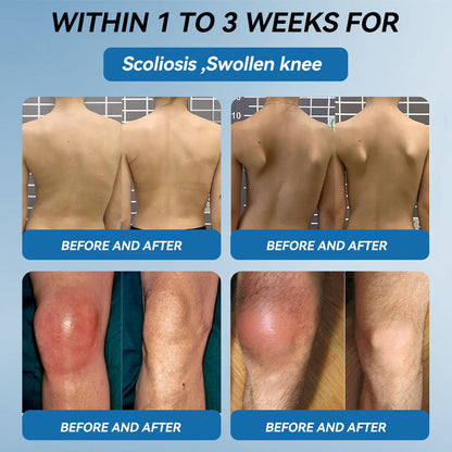 | 𝐋𝐚𝐬𝐭 𝐃𝐚𝐲 𝐏𝐫𝐨𝐦𝐨𝐭𝐢𝐨𝐧 𝟖𝟎% 𝐎𝐅𝐅 |LIMETOW® ʙ.ᴘ.ᴄ-157 Joint Healing Cream🦴Treats Arthritis, Neuropathy, Rheumatism, Sports Injuries & More🌸🌸