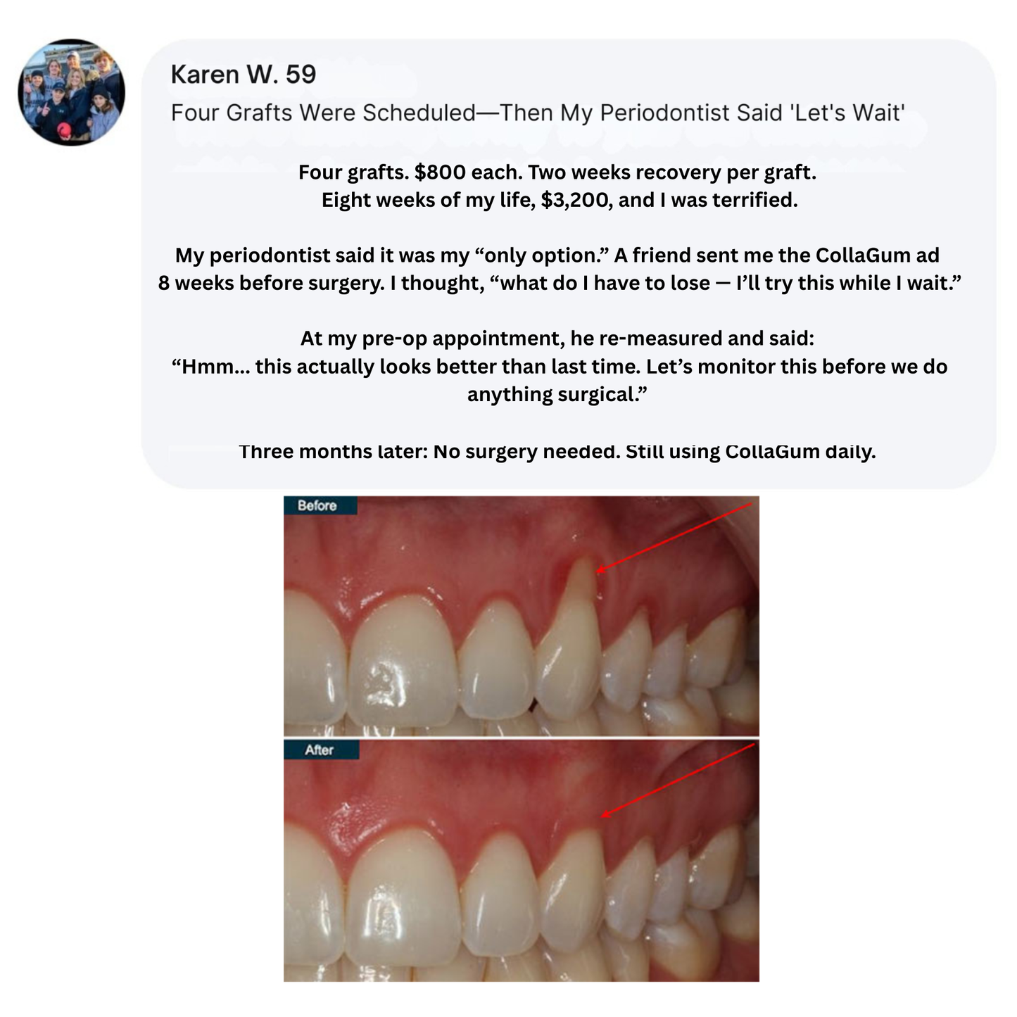 Collagum Smile Strengthening Collagen Powder
