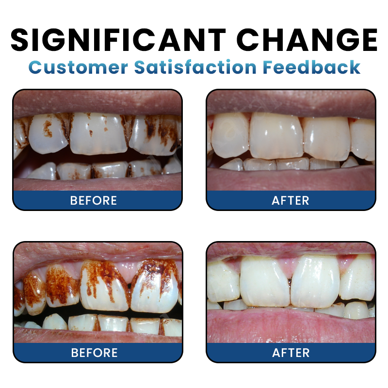 LIMETOW® Teeth Whitening Essence