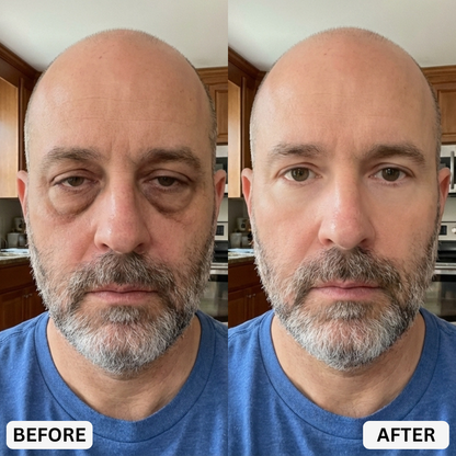 Eye Repair Stick