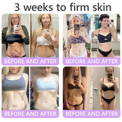 Limited-Time Offer⚡LIMETOW® PDRN Multi-Peptide Massaging Body Roller Cream- ✨𝐀𝐧𝐭𝐢-𝐚𝐠𝐢𝐧𝐠, Hydrating, Skin Firming & Lifting, Skin Repair, Even Tone, Acne and Dark Spot Treatment, Wart and Mole Removal, and Psoriasis Relief