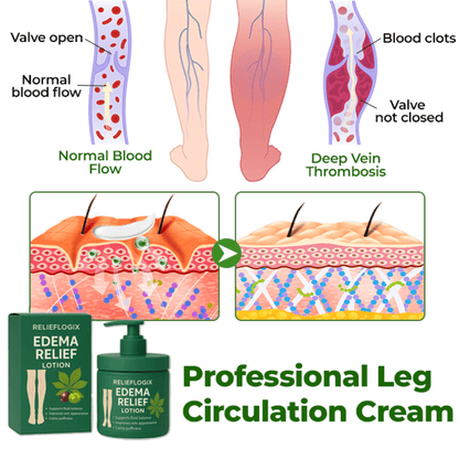 #1 Best Seller- 💥EDEMA RELIEF LOTION