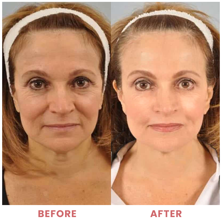 LIMETOW™ Compact Anti-wrinkle Bar image LIMETOW™ Compact Anti-wrinkle Bar