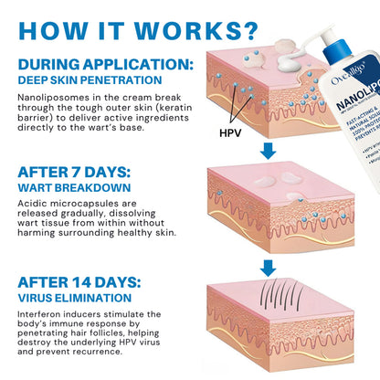 NanoLipo HPV Genital Warts Eraser Cream Plus+