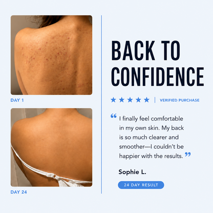 Back Acne Bar