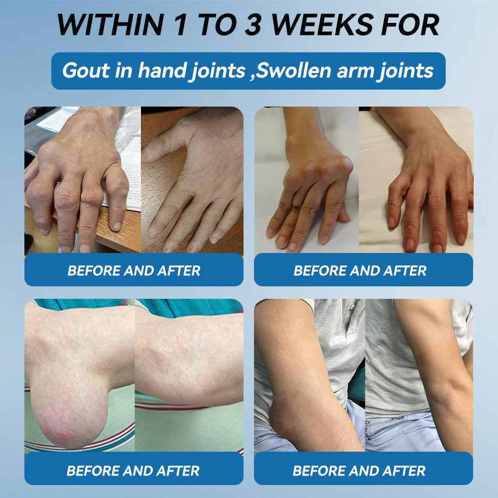 | 𝐋𝐚𝐬𝐭 𝐃𝐚𝐲 𝐏𝐫𝐨𝐦𝐨𝐭𝐢𝐨𝐧 𝟖𝟎% 𝐎𝐅𝐅 |LIMETOW® ʙ.ᴘ.ᴄ-157 Joint Healing Cream🦴Treats Arthritis, Neuropathy, Rheumatism, Sports Injuries & More🌸🌸