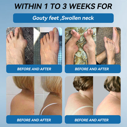 | 𝐋𝐚𝐬𝐭 𝐃𝐚𝐲 𝐏𝐫𝐨𝐦𝐨𝐭𝐢𝐨𝐧 𝟖𝟎% 𝐎𝐅𝐅 |LIMETOW® ʙ.ᴘ.ᴄ-157 Joint Healing Cream🦴Treats Arthritis, Neuropathy, Rheumatism, Sports Injuries & More🌸🌸