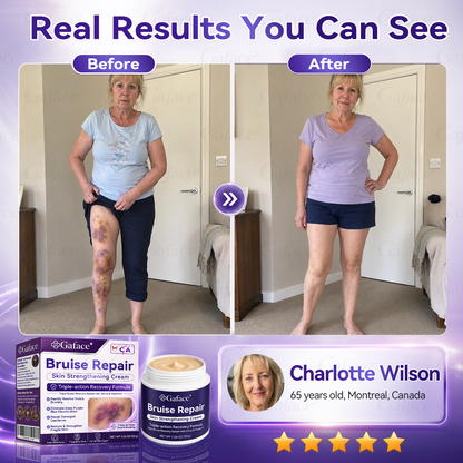 LIMETOW® Bruise Repair & Skin-Strengthening Cream