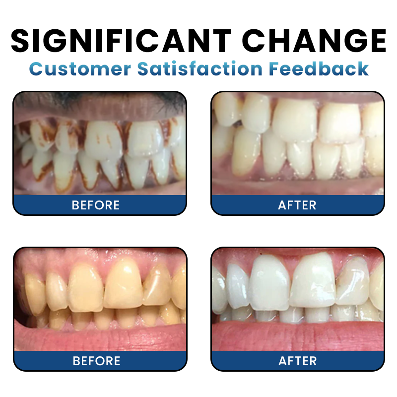 LIMETOW® Teeth Whitening Essence