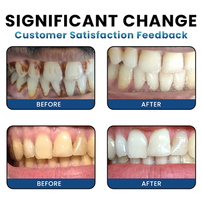 LIMETOW® Teeth Whitening Essence