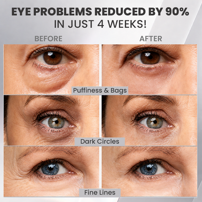 LIMETOW® Ultimate Depuff Eye Serum⚡Limited-Time Offer